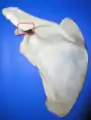 Left scapula. Posterior view. Acromional angle labeled in red.