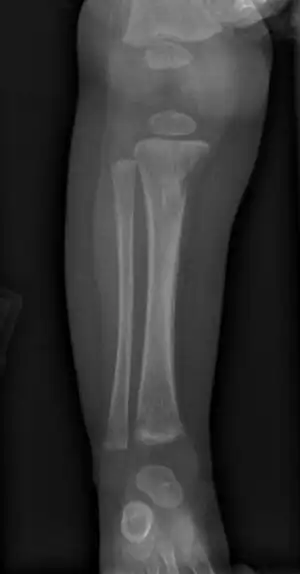 Wimberger corner sign