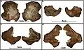 Burial 17 - Pelvis and scapulas that were part of the bundle deposited next to the adult cranium,