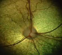 Image 46Dog retina showing optic disc and vasculature [epiCam] (from Dog anatomy)
